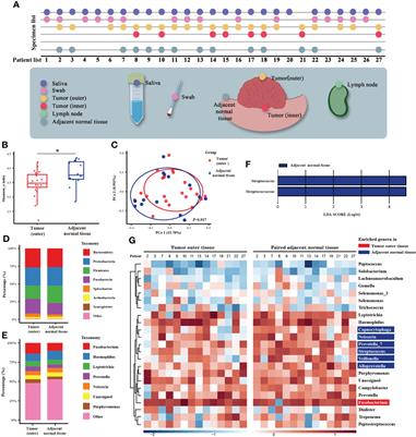 The oral cancer microbiome contains tumor space–specific and clinicopathology-specific bacteria